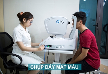 Chup day mat mau ava3