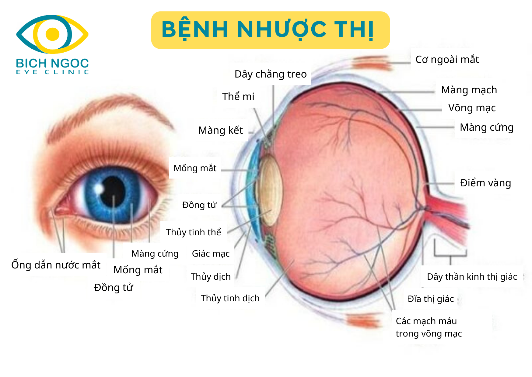 bệnh nhược thị là gì