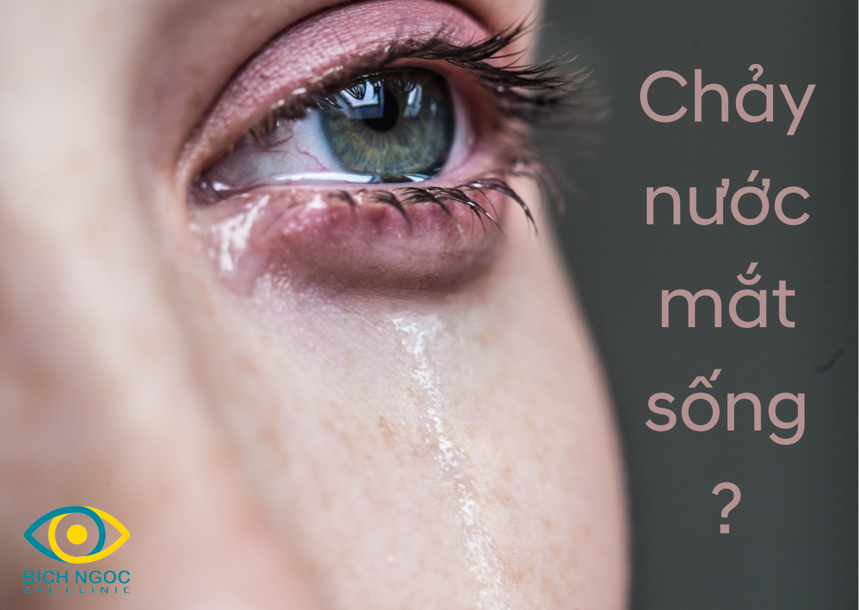 chảy nước mắt sống và cách điều trị