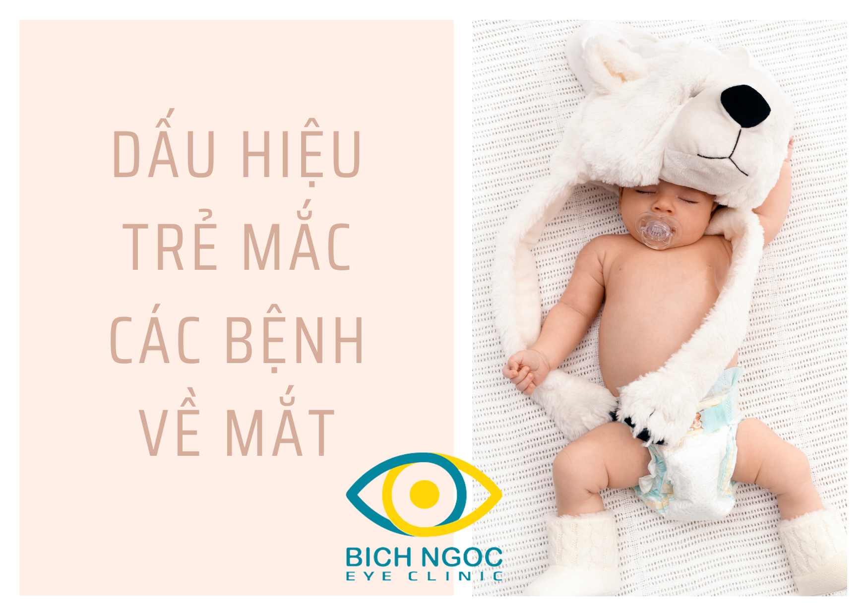 dáu hiệu trẻ mắc các bệnh về mắt