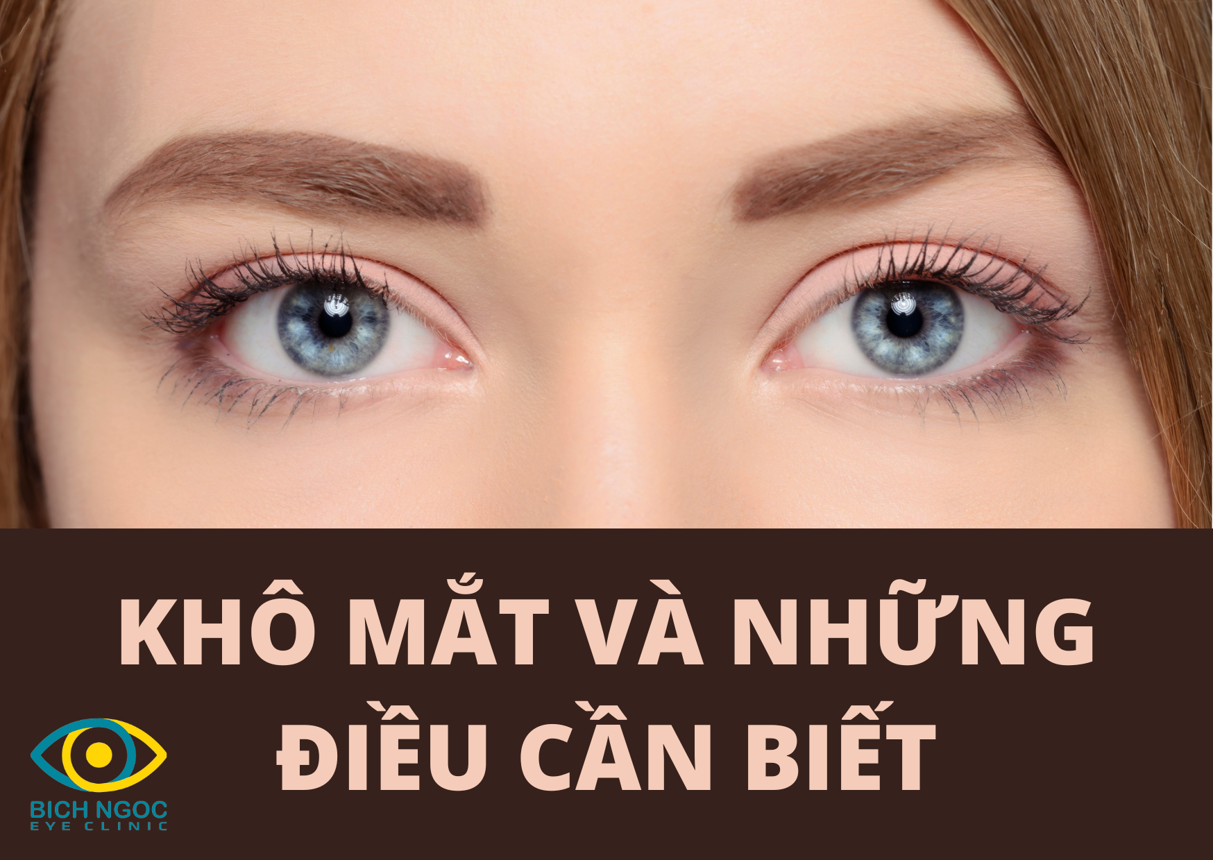khô mắt và những điều cần biết