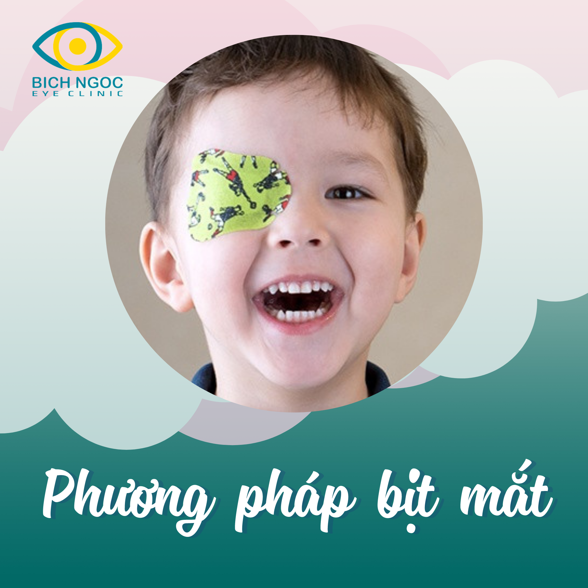 phương pháp bịt mắt