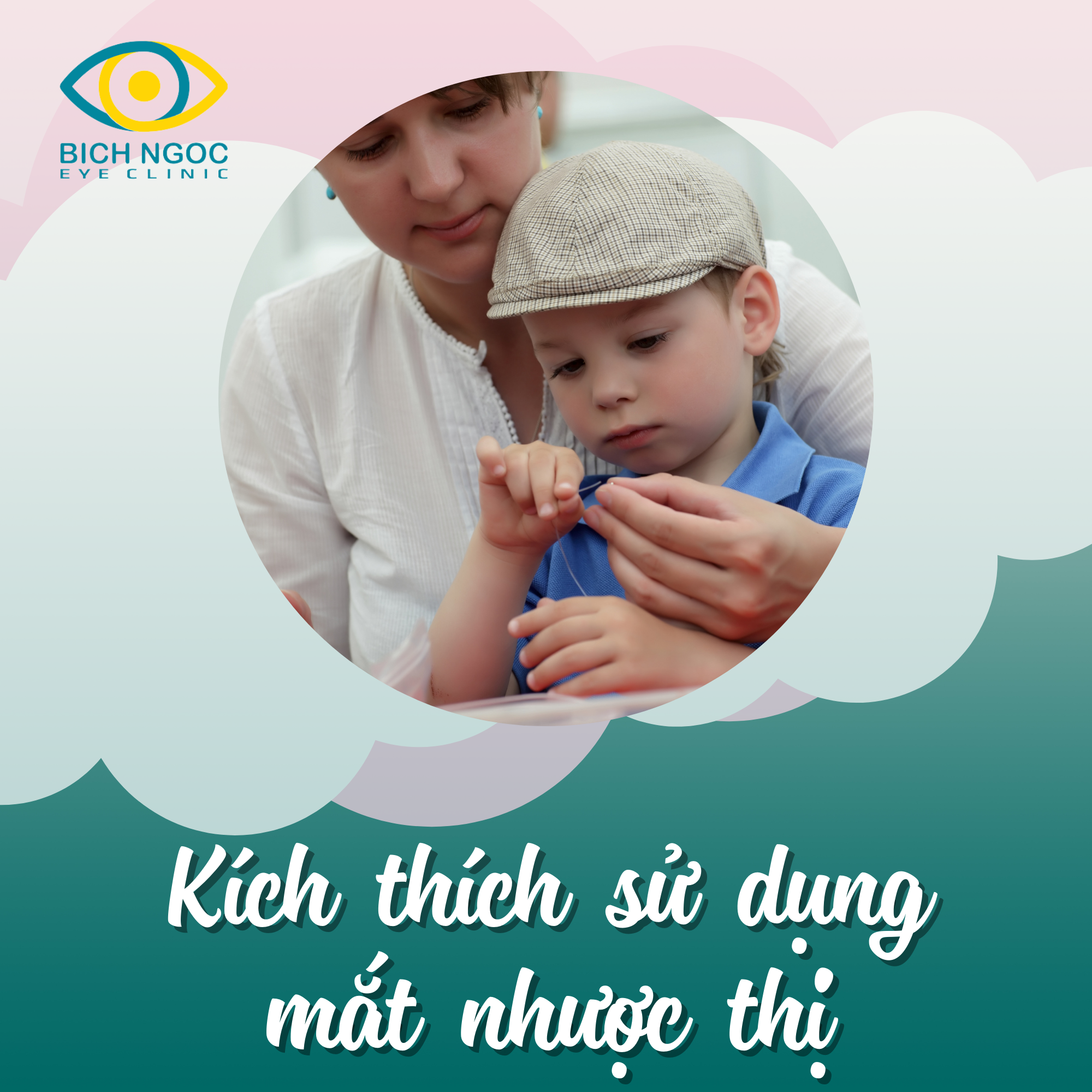 kích thích sử dụng mắt nhược thị