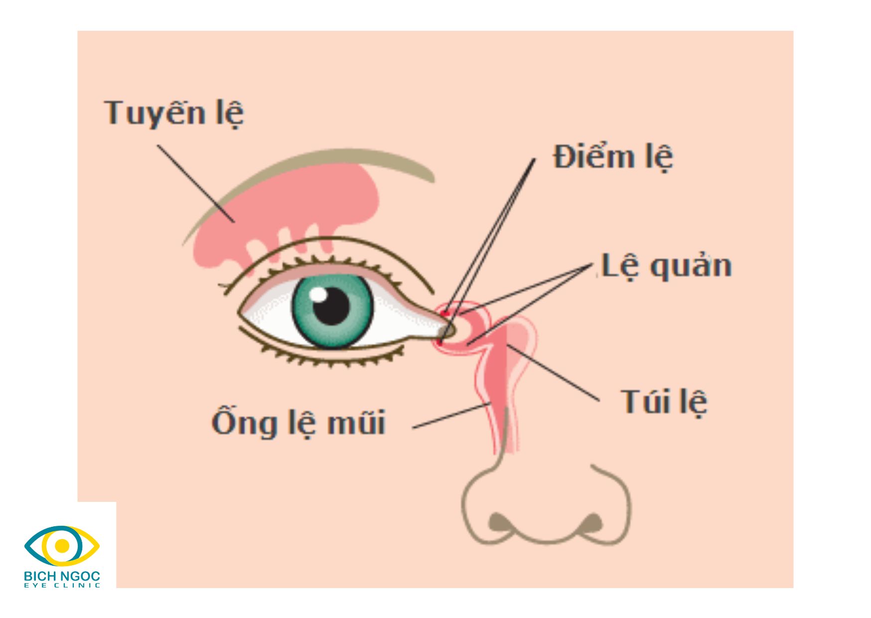ngứa khóe mắt do viêm túi lệ
