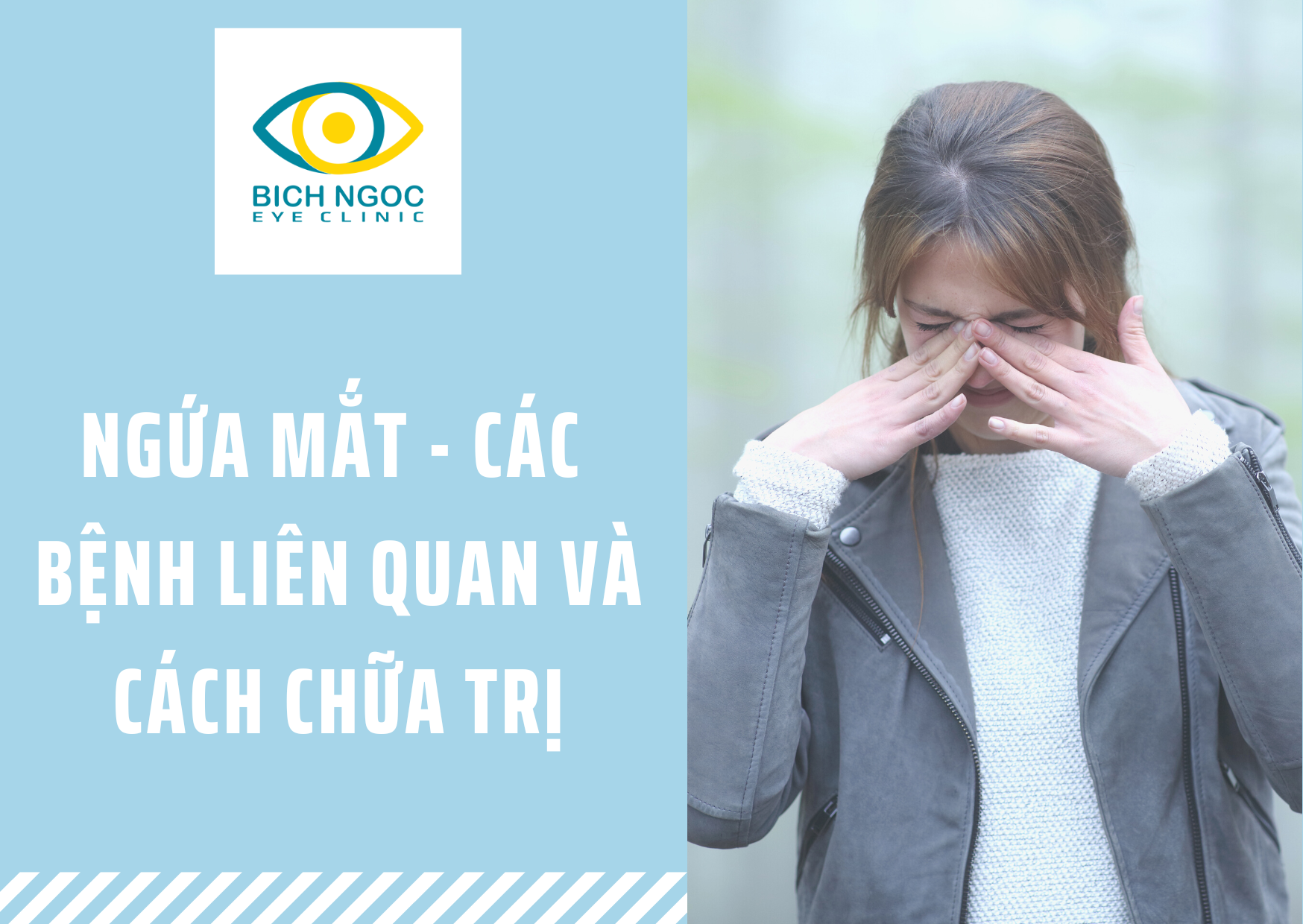 ngứa mắt các bệnh liên quan và cách điều trị