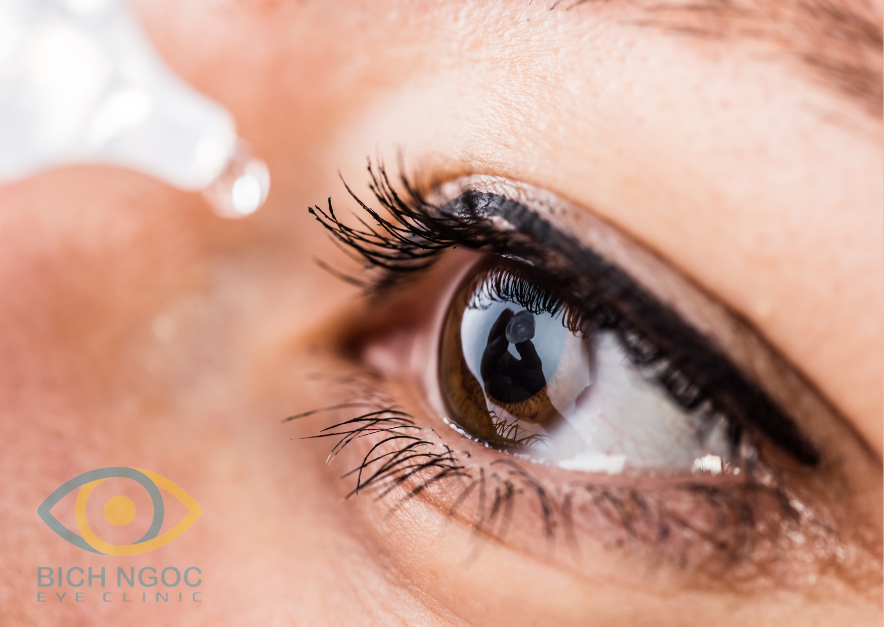 thuốc nhỏ mắt trị ngứa mắt